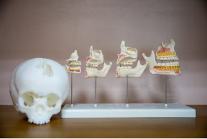 small-princess-sirindhorn-craniofacial